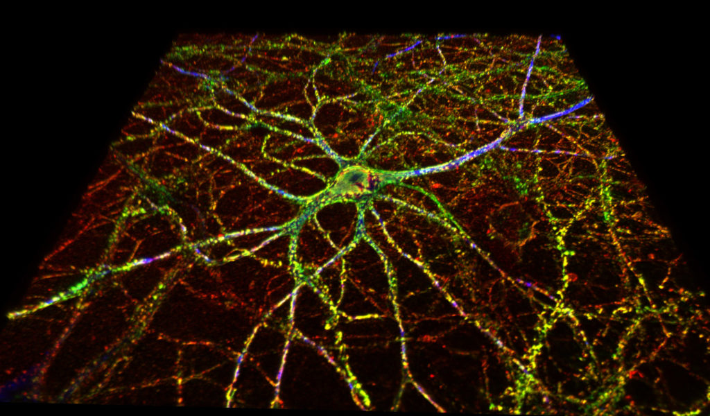 Image of a colored synapse