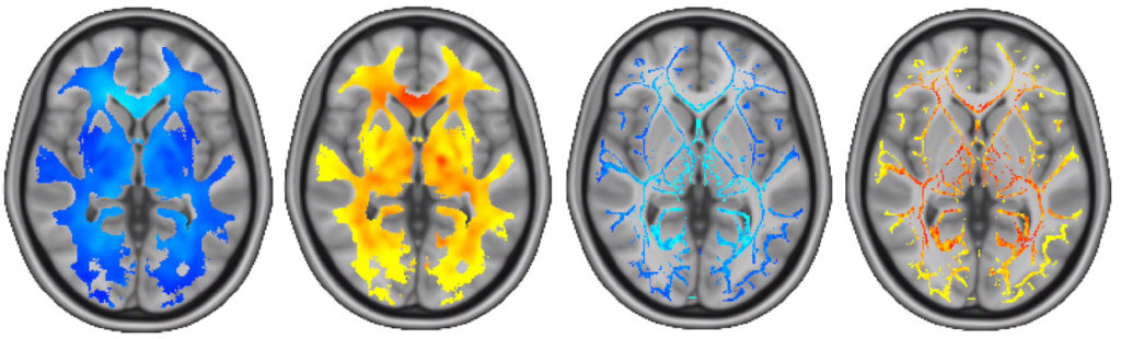 Graphic of a human brain by Marco Taubert